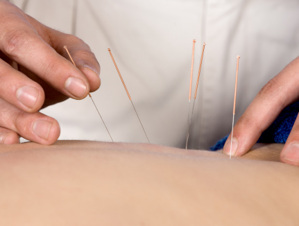Min Chiropractic - Acupuncture